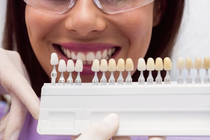 Exploring Different Types of Crowns and Bridges for Missing Teeth